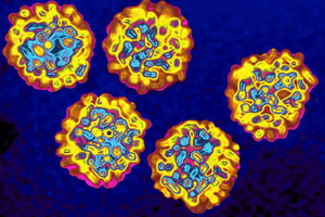 Хронический гепатит печени: виды, симптомы и лечение