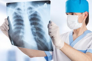 Выявление и диагностика туберкулеза в современной медицине