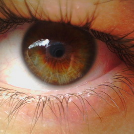 Отслоение сетчатки глаза симптомы фото