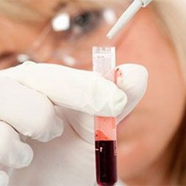 Виды анемий у взрослых при сниженном гемоглобине thumbnail