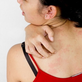 Как вылечить кожные заболевания в домашних условиях